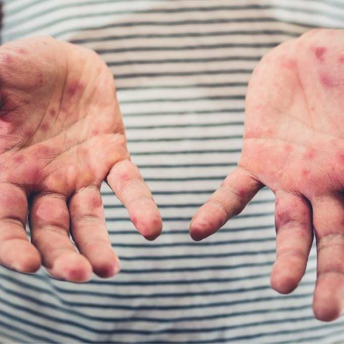 Infectious Disease Cleanup In Missouri	Near Me Infectious Disease Cleanup In Missouri	Near Me